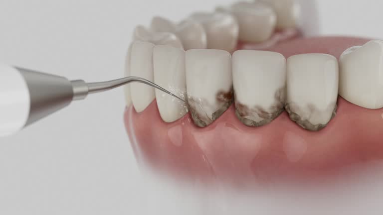 Trusted Emergency Dentist service in Dennison, OH - Dentist Open Now